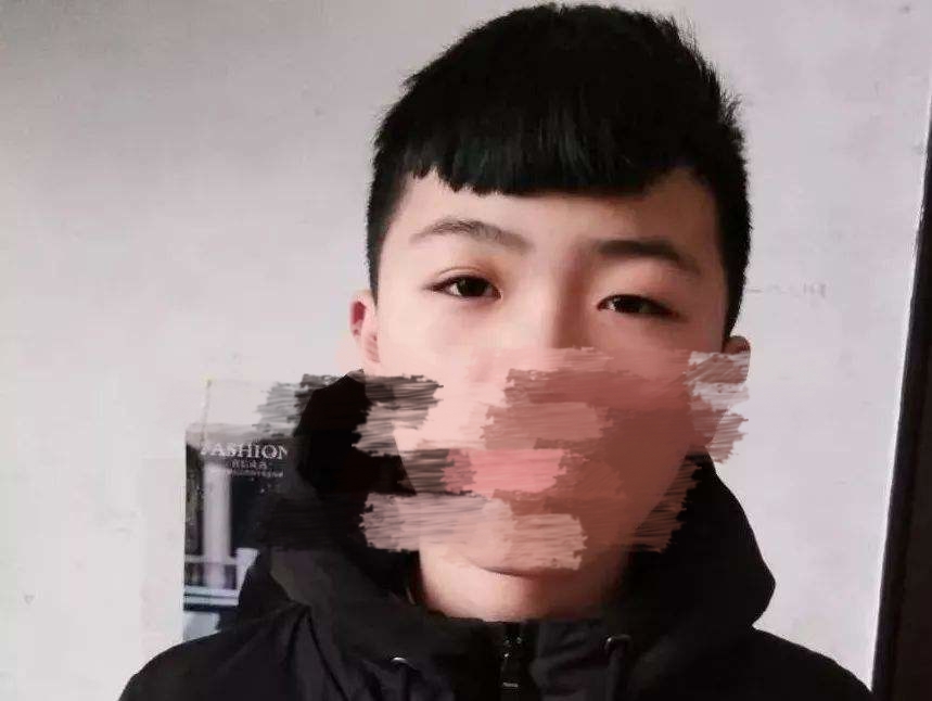 雙眼皮最晚幾歲長(zhǎng)出來(慢慢長(zhǎng)出雙眼皮的特征)