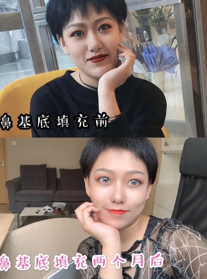 為什么整容變化那么大(為什么我整容沒有太大的變化)