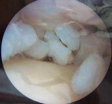 為什么看到血腿軟(看到針就腿軟為什么)